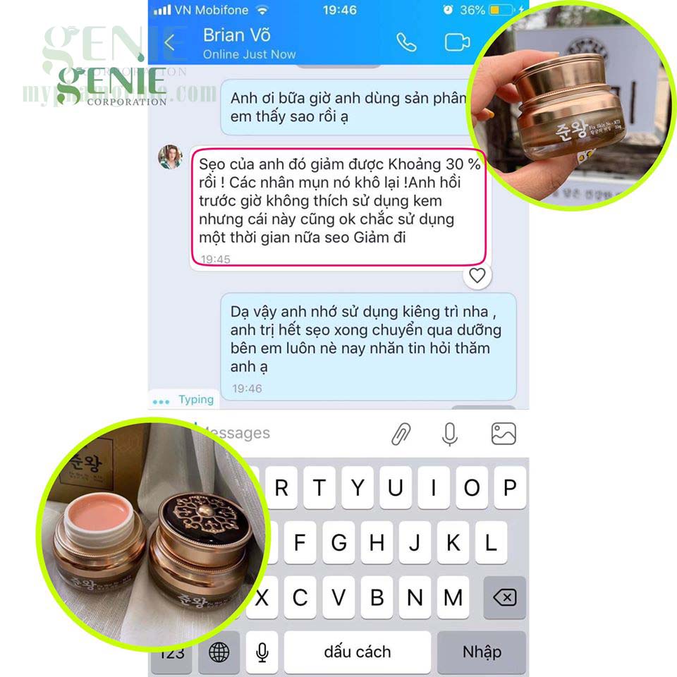 kem trị sẹo rỗ genie | kem trị sẹo rỗ hàn quốc