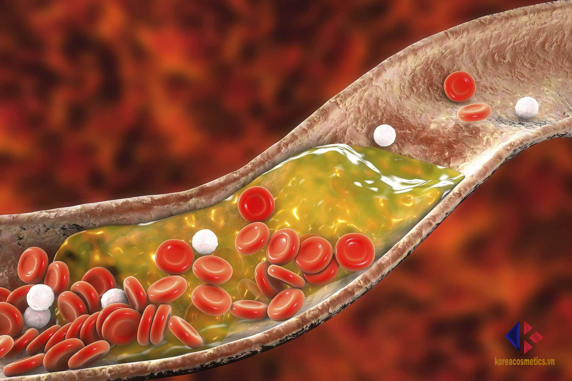 giảm cholesterol trong máu | cholesteol từ đâu mà có