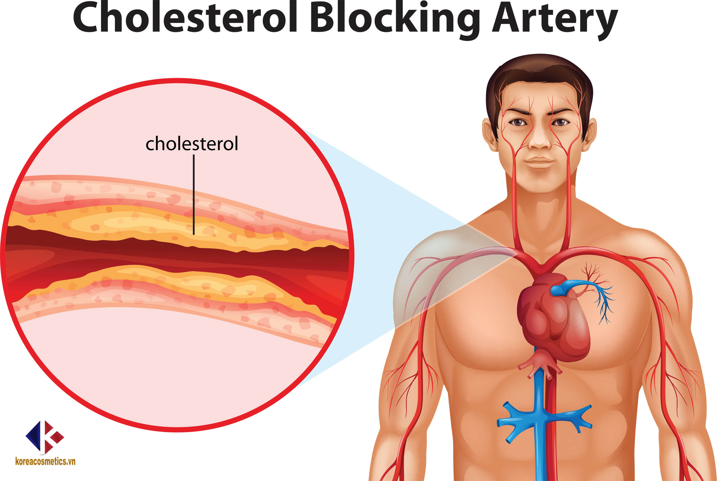 giảm cholesterol trong máu | cholesteol từ đâu mà có