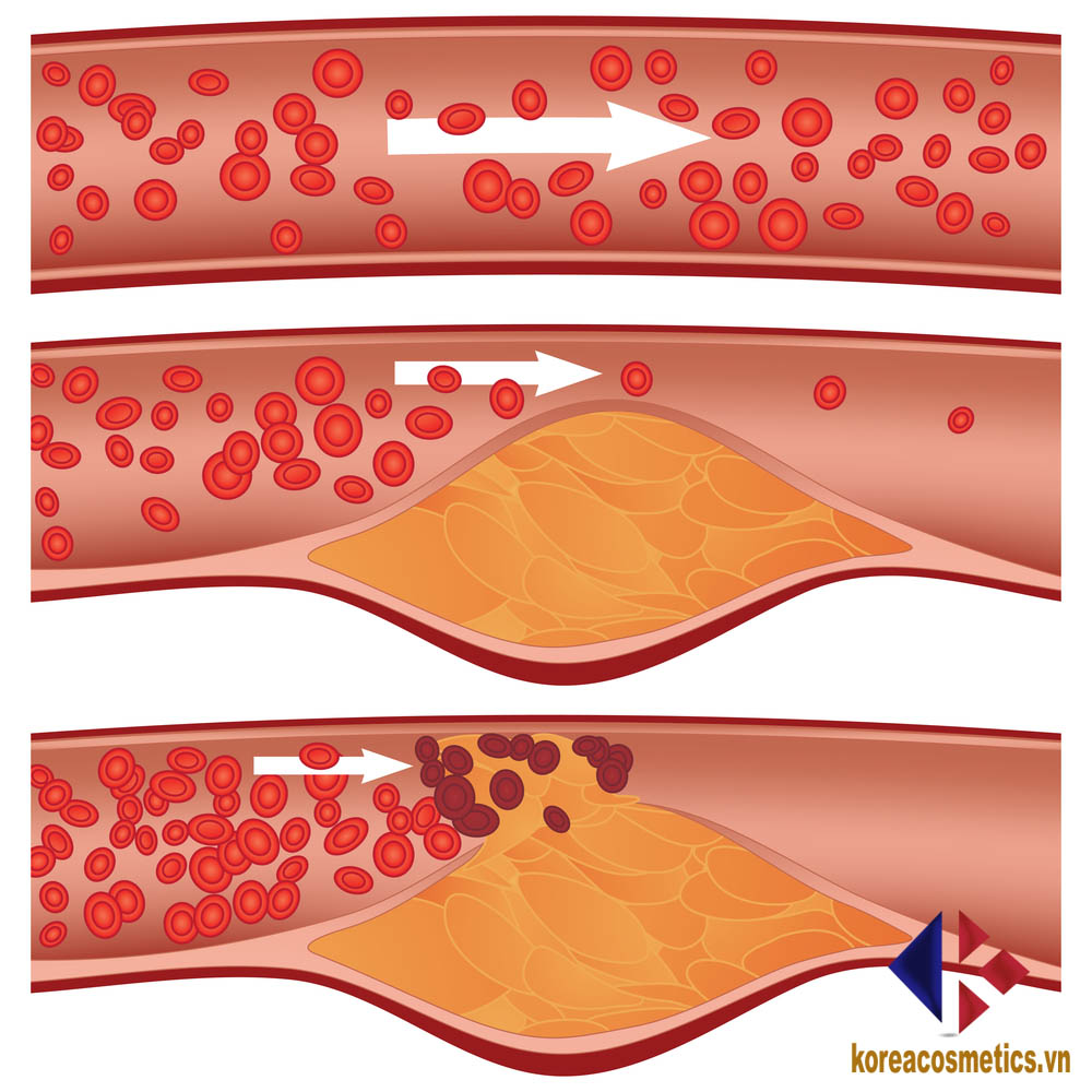 cholesterol là gì | cholesterol có hại không