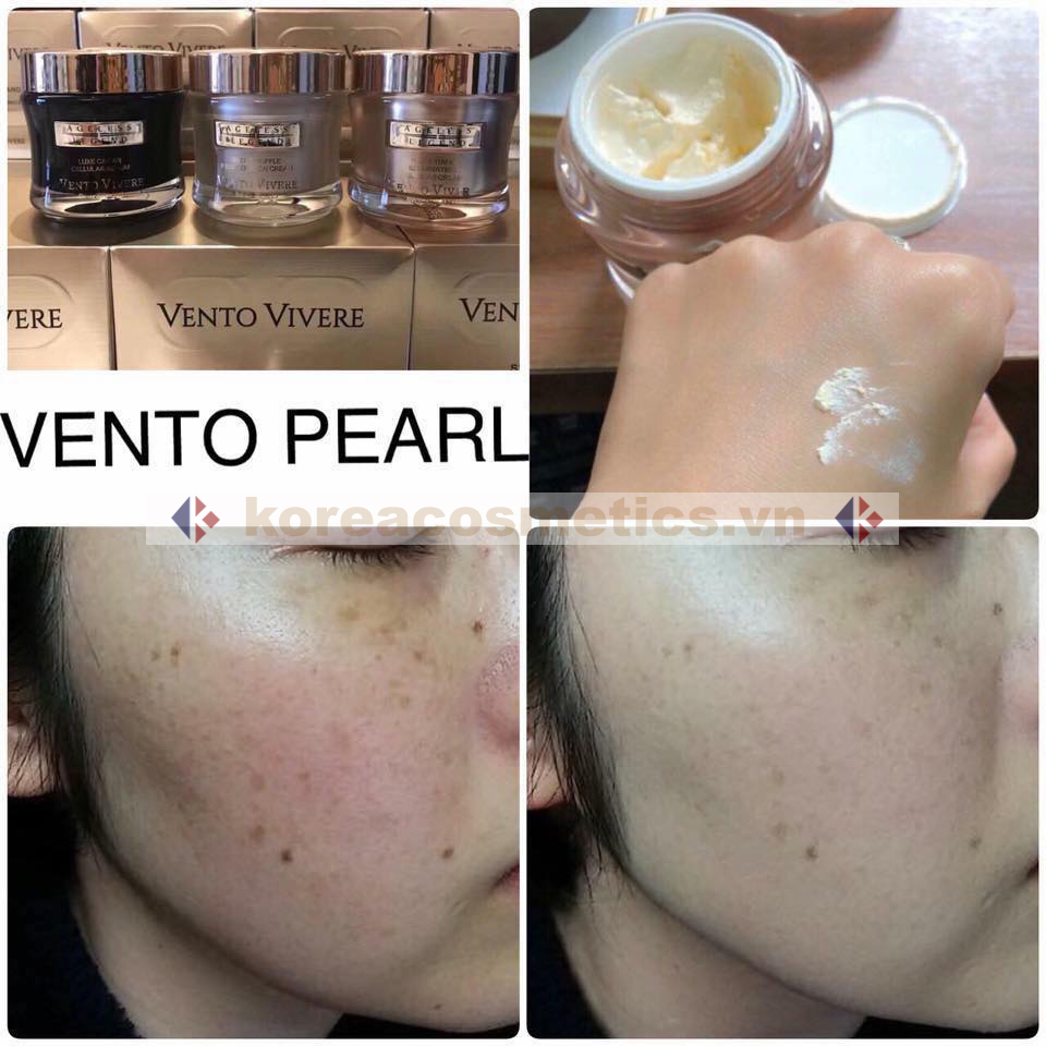 kem vento | kem thụy sĩ | vento vivere | review vento